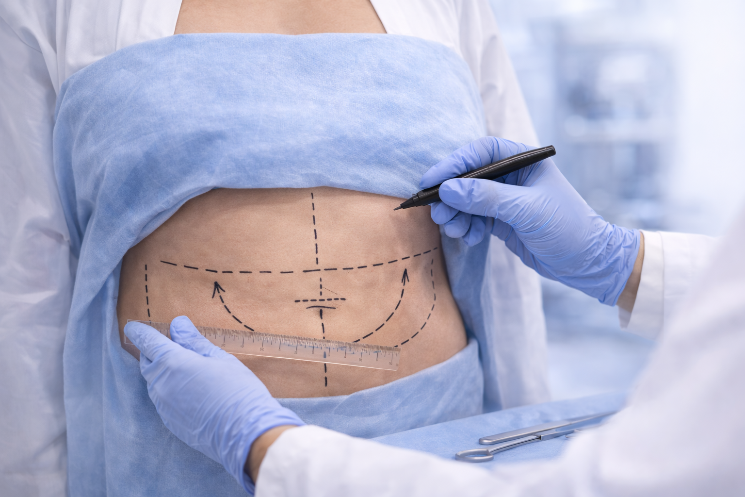 Karın Germe için klinik ortam konsept görseli